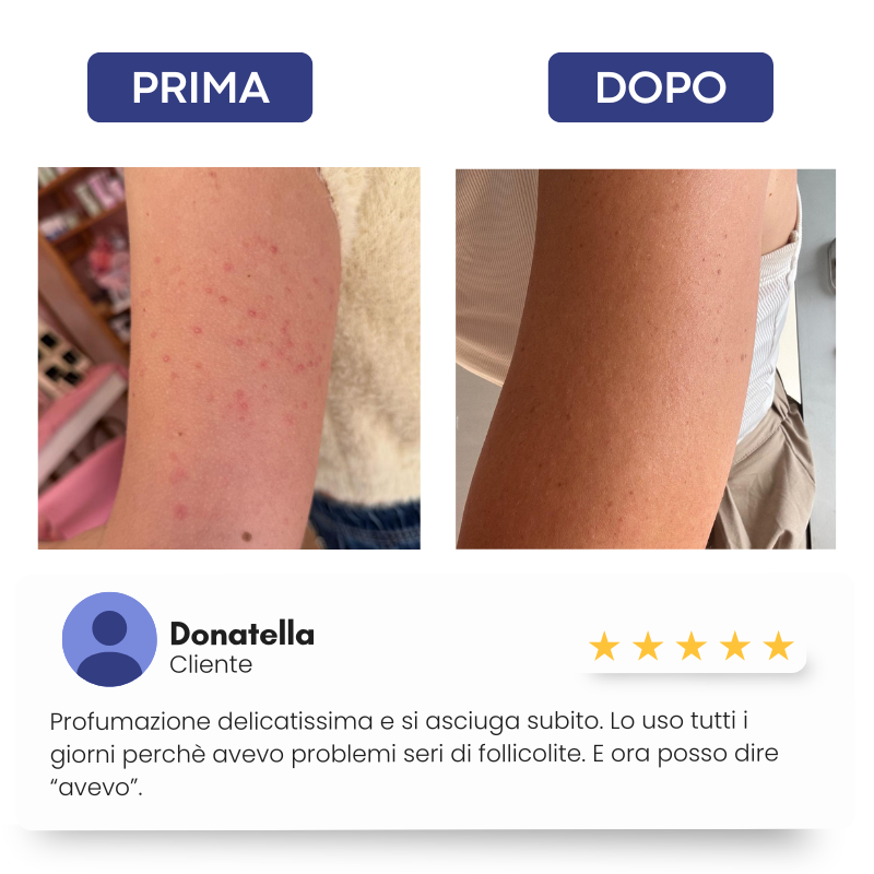 N°2 PURE WIRKSTOFFE Follikulitis und Dehnungsstreifen - KÖRPERKOMPLEX