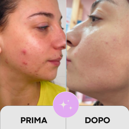 DIVA DIVINE Alpha-Hydroxysäure (AHA) Nacht-Booster für Falten, Mitesser, Pickel und Unreinheiten